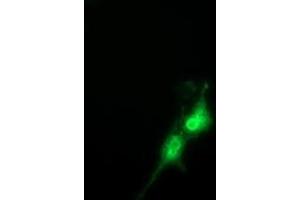 Anti-FAM84B mouse monoclonal antibody (ABIN2453031) immunofluorescent staining of COS7 cells transiently transfected by pCMV6-ENTRY FAM84B (RC207996). (FAM84B 抗体)