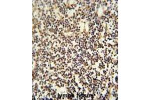 Immunohistochemistry (IHC) image for anti-PARP1 Binding Protein (PARPBP) antibody (ABIN2995516) (PARPBP 抗体)