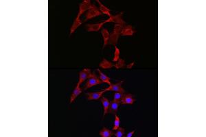 Immunofluorescence (IF) image for anti-Signal Transducer and Activator of Transcription 3 (Acute-Phase Response Factor) (STAT3) antibody (ABIN7270305)