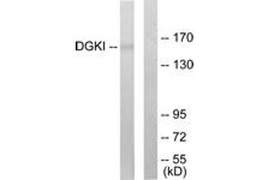 Western blot analysis of extracts from 293 cells, using DGKI Antibody. (DGKI 抗体  (AA 991-1040))