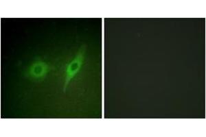 Immunofluorescence analysis of HeLa cells, using Collagen IV alpha2 Antibody. (COL4a2 抗体  (AA 151-200))