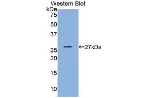 Detection of Recombinant GSTk1, Mouse using Polyclonal Antibody to Glutathione S Transferase Kappa 1 (GSTk1) (GSTK1 抗体  (AA 19-222))