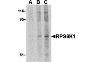 Western Blotting (WB) image for anti-RPS6K1 (C-Term) antibody (ABIN1030629) (RPS6K1 (C-Term) 抗体)