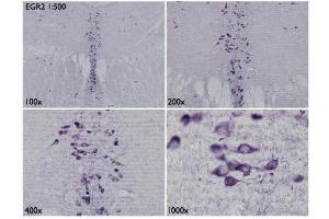 IHC-Fr Image Immunohistochemical analysis of mouse brain tissue (paraformaldehyde-fixed frozen sections), using EGR2, antibody at 1:500 dilution. (EGR2 抗体)