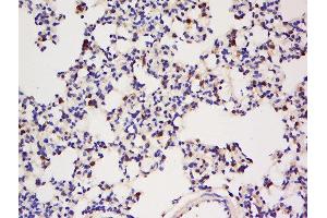 Formalin-fixed and paraffin embedded rat lung tissue labeled with Anti-IGBP1 Polyclonal Antibody, Unconjugated  at 1:200 followed by conjugation to the secondary antibody and DAB staining. (IGBP1 抗体  (AA 151-250))