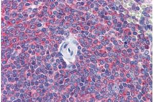 Human Spleen: Formalin-Fixed, Paraffin-Embedded (FFPE) (SNAPIN 抗体  (AA 41-137))