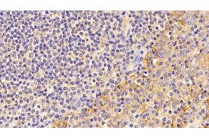 Detection of ATP1a1 in Human amygdalitis Tissue using Monoclonal Antibody to ATPase, Na+/K+ Transporting Alpha 1 Polypeptide (ATP1a1) (ATP1A1 抗体  (AA 493-660))