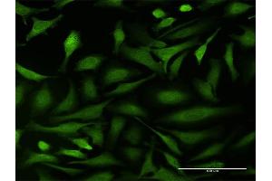 Immunofluorescence of purified MaxPab antibody to BCAR1 on HeLa cell. (BCAR1 抗体  (AA 1-870))