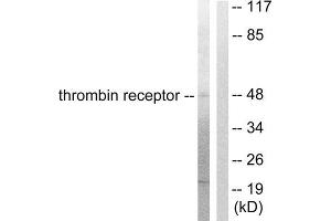Western Blotting (WB) image for anti-Coagulation Factor II (thrombin) Receptor (F2R) (N-Term) antibody (ABIN1848802) (PAR1 抗体  (N-Term))
