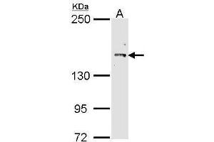 Western Blotting (WB) image for anti-Cullin 7 (CUL7) (C-Term) antibody (ABIN2856935)