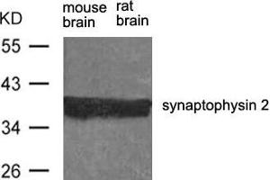 Western blot analysis of extract from rat brain and mouse brain using synaptophysin 2 Antibody. (Synaptoporin 抗体)