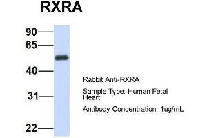 Host:  Rabbit  Target Name:  RXRA  Sample Type:  Human Fetal Heart  Antibody Dilution:  1. (Retinoid X Receptor alpha 抗体  (N-Term))