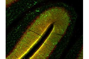 Indirect immunolabeling of mouse cerebellum section with anti-homer 3 (dilution 1 : 500; red) and anti-synapsin (, dilution 1 : 500; green).