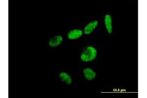 Immunofluorescence of purified MaxPab antibody to RBM15 on HeLa cell. (RBM15 抗体  (AA 1-544))