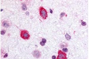 Anti-GALR3 antibody  ABIN1048648 IHC staining of rat brain, hippocampus.