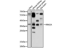 Western blot analysis of extracts of various cell lines, using RRAGA antibody (ABIN6293916) at 1:1000 dilution. (RRAGA 抗体)
