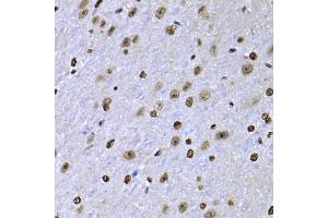 Immunohistochemistry of paraffin-embedded mouse brain using SOX5 antibody (ABIN5974201) at dilution of 1/100 (40x lens). (SOX5 抗体)
