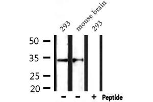 Western blot analysis of extracts from 293 and mouse brain, using CD38 Antibody.