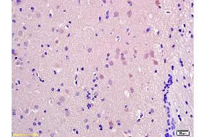 Formalin-fixed and paraffin embedded rat brain labeled with Anti-SRRM2 Polyclonal Antibody, Unconjugated (ABIN873267) at 1:200 followed by conjugation to the secondary antibody and DAB staining. (SRRM2 抗体  (AA 101-230))