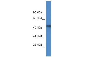 Western Blot showing AGPAT4 antibody used at a concentration of 1 ug/ml against MCF7 Cell Lysate (AGPAT4 抗体  (Middle Region))