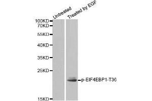 Western blot analysis of extracts from MDA-MB-435 cells, using Phospho-EIF4EBP1-T36 antibody. (eIF4EBP1 抗体  (pThr36))