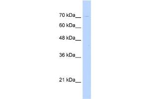 WB Suggested Anti-KIAA1333 Antibody Titration:  0. (G2E3 抗体  (N-Term))
