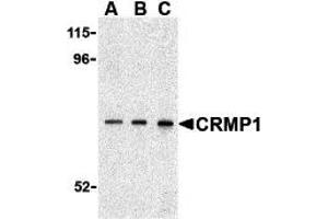 Western Blotting (WB) image for anti-Collapsin Response Mediator Protein 1 (CRMP1) (C-Term) antibody (ABIN1030345) (CRMP1 抗体  (C-Term))