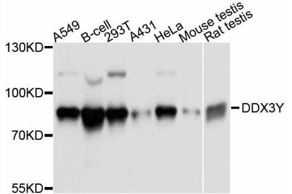 DDX3Y anticorps  (AA 1-210)