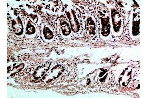 Immunohistochemical analysis of paraffin-embedded human-colon, antibody was diluted at 1:200 (VHL 抗体  (AA 1-50))