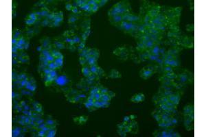 Anti-PFKFB4 mouse monoclonal antibody (ABIN2453452) immunofluorescent staining of COS7 cells transiently transfected by pCMV6-ENTRY PFKFB4 (RC201573). (PFKFB4 抗体)