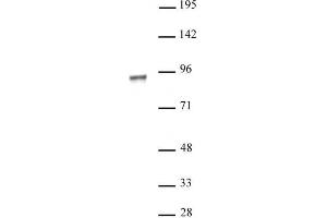 NR3C1 antibody (pAb) tested by Western blot. (Glucocorticoid Receptor 抗体)