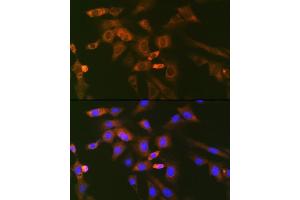 Immunofluorescence analysis of NIH-3T3 cells using Ube2N/Ubc13 Rabbit mAb (ABIN7271179) at dilution of 1:100 (40x lens). (UBE2N 抗体)