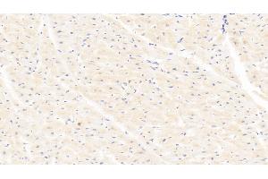 Detection of LOX in Human Cardiac Muscle Tissue using Polyclonal Antibody to Lysyl Oxidase (LOX) (LOX 抗体  (AA 213-417))