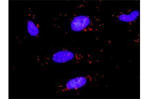 Proximity Ligation Analysis of protein-protein interactions between TRAF2 and ZBTB16. (ZBTB16 抗体  (AA 381-480))