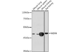 WDR4 抗体