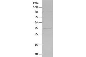 Sestrin 2 Protein (SESN2) (AA 217-480) (His tag)