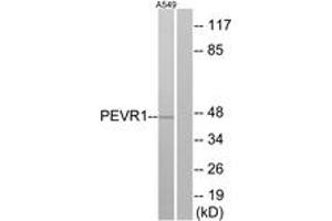 Western Blotting (WB) image for anti-G Protein-Coupled Receptor 172A (GPR172A) (AA 43-92) antibody (ABIN2891074) (GPR172A 抗体  (AA 43-92))