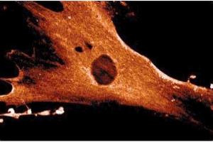 Immunofluorescence staining of WI-38 cells (Human lung fibroblasts, ATCC CCL-75). (ANXA6 抗体  (AA 1-673))