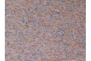 DAB staining on IHC-P; Samples: Rat Cerebrum Tissue (CYP7A1 抗体  (AA 109-383))