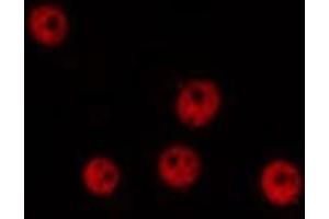 Immunofluorescence (fixed cells) (IF/ICC) image for anti-Menage A Trois Homolog 1, Cyclin H Assembly Factor (Xenopus Laevis) (MNAT1) (N-Term) antibody (ABIN6263313)