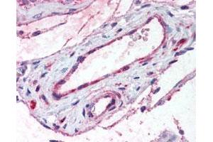 Immunohistochemical (Formalin/PFA-fixed paraffin-embedded sections) staining in vessels of human testis. (ADAMTS1 抗体)