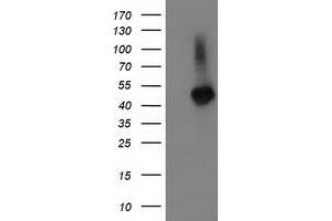 Image no. 1 for anti-Tubulin Folding Cofactor E-Like (TBCEL) antibody (ABIN1501325) (TBCEL 抗体)