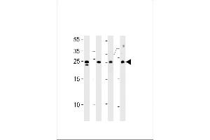TSN Antibody (Center) (ABIN656310 and ABIN2845612) western blot analysis in HL-60,Jurkat,K562 cell line mouse spleen tissue lysates (35 μg/lane).