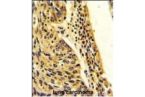 Immunohistochemistry (Paraffin-embedded Sections) (IHC (p)) image for anti-Folylpolyglutamate Synthase (FPGS) (AA 304-330) antibody (ABIN390963)