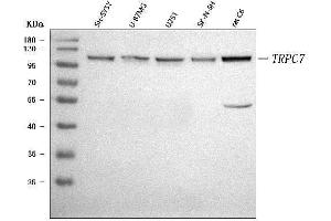 Western blot analysis of TRP 7/TRPC7 using anti-TRP 7/TRPC7 antibody (ABIN7601845).