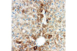 Anti- CYP2E1 antibody, IHC(P) IHC(P): Rat Liver Tissue (CYP2E1 抗体  (AA 1-310))