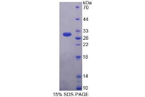 SDS-PAGE analysis of Chicken GSTa3 Protein. (GSTA3 蛋白)