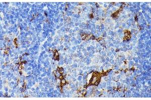 Immunohistochemistry of paraffin-embedded Mouse spleen using TIAL1 Polyclonal Antibody at dilution of 1:100 (40x lens). (TIAL1 抗体)