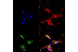 Immunocytochemistry (ICC) image for anti-SH3 and Multiple Ankyrin Repeat Domains 3 (SHANK3) (AA 840-857) antibody (Atto 390) (ABIN2485402)