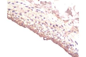 Formalin-fixed and paraffin-embedded rat Carotid artery labeled with Rabbit Anti-IGF-I Polyclonal Antibody , Unconjugated at 1:200 followed by conjugation to the secondary antibody and DAB staining (IGF1 抗体  (AA 49-100))